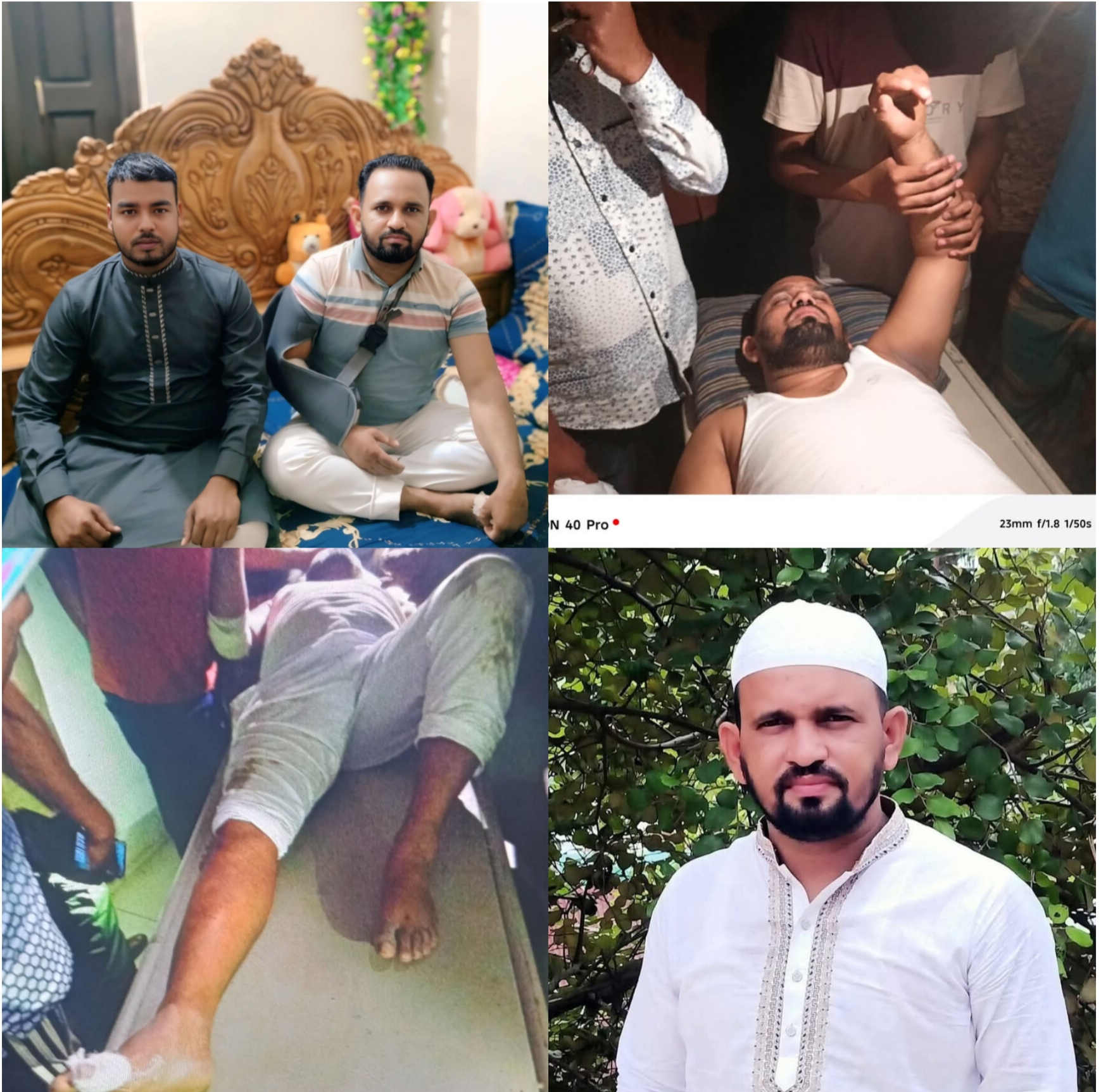 কমলগঞ্জে সাংবাদিক আকাশের ওপর বর্বরোচিত হামলা: শনাক্ত হলেও অধরা হামলাকারীরা